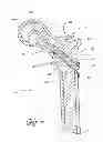 Fig. 03 - Distal bone anchors for bone fixation with secondary compression