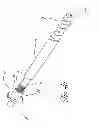 Fig. 09 - Distal bone anchors for bone fixation with secondary compression
