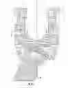 Fig. 05 - Bone fixation assembly