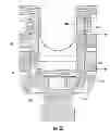 Fig. 08 - Bone fixation assembly