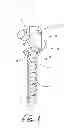 Fig. 02 - Pivotal bone anchor assembly with biased bushing for pre-lock friction fit