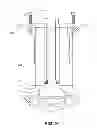 Fig. 10 - Laminoplasty system
