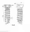 Fig. 07 - Locking bone screws and methods of use thereof