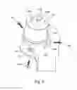 Fig. 03 - Guide tool for cartilage repair