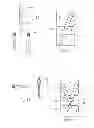 Fig. 06 - Systems and methods for the fixation or fusion of bone