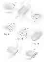 Fig. 08 - Systems and methods for the fixation or fusion of bone
