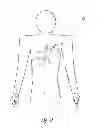 Fig. 02 - Modular antitachyarrhythmia therapy system