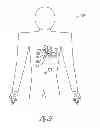 Fig. 06 - Modular antitachyarrhythmia therapy system