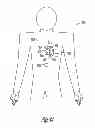 Fig. 16 - Modular antitachyarrhythmia therapy system