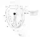 Fig. 07 - Methods and apparatus for predicting acute response to cardiac resynchronization therapy at a given stimulation site