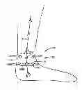 Fig. 01 - Tibial nerve stimulation therapy device calibration