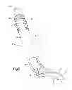 Fig. 05 - Eyelid treatment device