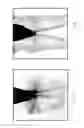 Fig. 05 - ENHANCED LIGHT BASED LIPOPLASTY