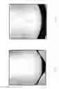 Fig. 06 - ENHANCED LIGHT BASED LIPOPLASTY