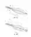 Fig. 08 - Cryotherapeutic devices having integral multi-helical balloons and methods of making the same
