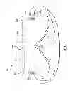 Fig. 03 - THERMAL COMPRESS SYSTEM AND METHODS OF USING THE SAME