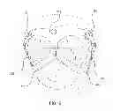 Fig. 16 - THERMAL COMPRESS SYSTEM AND METHODS OF USING THE SAME