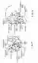 Fig. 02 - EXTRACRANIAL IMPLANTABLE DEVICES, SYSTEMS AND METHODS FOR THE TREATMENT OF MEDICAL DISORDERS