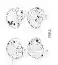 Fig. 05 - EXTRACRANIAL IMPLANTABLE DEVICES, SYSTEMS AND METHODS FOR THE TREATMENT OF MEDICAL DISORDERS