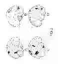 Fig. 06 - EXTRACRANIAL IMPLANTABLE DEVICES, SYSTEMS AND METHODS FOR THE TREATMENT OF MEDICAL DISORDERS