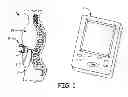 Fig. 02 - Wire configuration and method of making for an implantable medical apparatus
