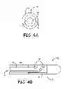 Fig. 04 - Wire configuration and method of making for an implantable medical apparatus
