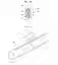 Fig. 04 - COCHLEAR ELECTRODE ARRAY