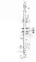 Fig. 03 - Intravascular shunt for traumatized arteries