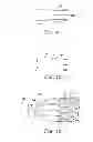Fig. 06 - Delivery systems and methods of implantation for prosthetic heart valves