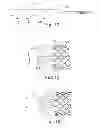 Fig. 08 - Delivery systems and methods of implantation for prosthetic heart valves