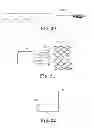 Fig. 09 - Delivery systems and methods of implantation for prosthetic heart valves