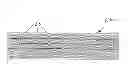 Fig. 01 - STENT WITH ELASTOMERIC ELEMENTS