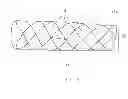 Fig. 06 - STENT WITH ELASTOMERIC ELEMENTS