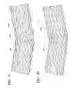 Fig. 03 - Flexible endoluminal device