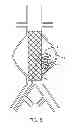 Fig. 07 - Devices and methods for treatment of vascular aneurysms