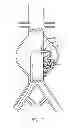 Fig. 13 - Devices and methods for treatment of vascular aneurysms