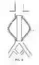 Fig. 20 - Devices and methods for treatment of vascular aneurysms
