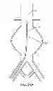 Fig. 23 - Devices and methods for treatment of vascular aneurysms
