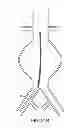Fig. 24 - Devices and methods for treatment of vascular aneurysms