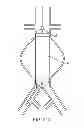 Fig. 25 - Devices and methods for treatment of vascular aneurysms