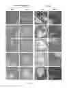 Fig. 06 - BIODEGRADABLE STENT FORMED WITH POLYMER-BIOCERAMIC NANOPARTICLE COMPOSITE AND METHOD OF MAKING THE SAME