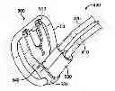Fig. 01 - Adjustable prosthetic anatomical device holder and handle for the implantation of an annuloplasty ring