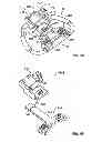 Fig. 04 - Adjustable prosthetic anatomical device holder and handle for the implantation of an annuloplasty ring