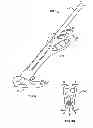 Fig. 08 - Adjustable prosthetic anatomical device holder and handle for the implantation of an annuloplasty ring