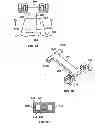 Fig. 09 - Adjustable prosthetic anatomical device holder and handle for the implantation of an annuloplasty ring
