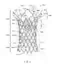 Fig. 04 - Valve Prosthesis Frames