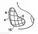 Fig. 01 - Tissue marking implant