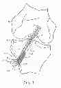Fig. 04 - FIXATION SCREW, GRAFT LIGAMENT ANCHOR ASSEMBLY, AND METHOD FOR SECURING A GRAFT LIGAMENT IN A BONE TUNNEL