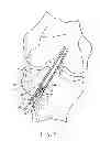 Fig. 05 - FIXATION SCREW, GRAFT LIGAMENT ANCHOR ASSEMBLY, AND METHOD FOR SECURING A GRAFT LIGAMENT IN A BONE TUNNEL