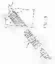 Fig. 06 - FIXATION SCREW, GRAFT LIGAMENT ANCHOR ASSEMBLY, AND METHOD FOR SECURING A GRAFT LIGAMENT IN A BONE TUNNEL